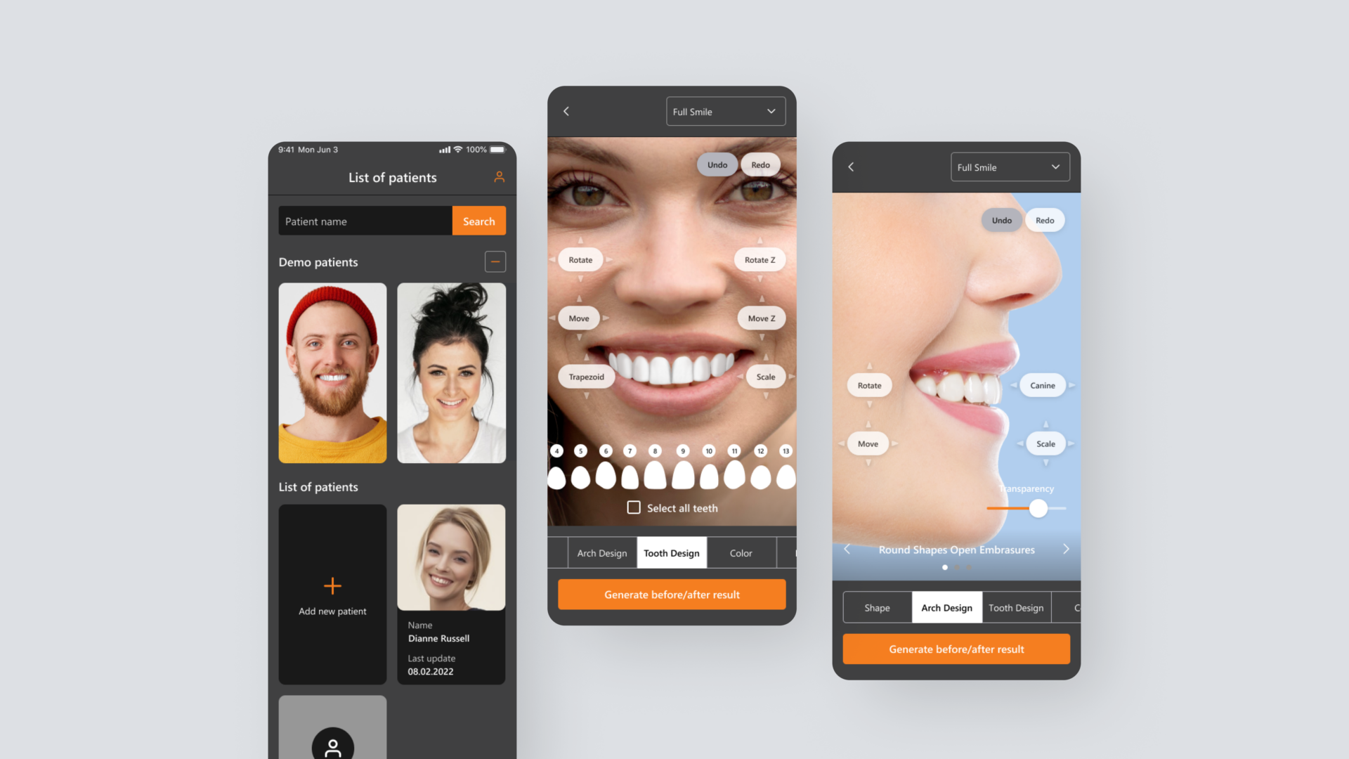 Dental programvare for bildebehandling