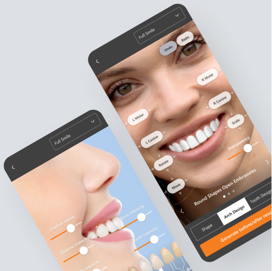 AI based dental solution