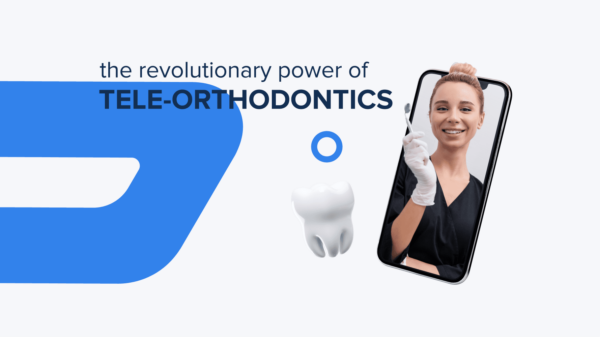 The Revolutionary Power of Tele-Orthodontics in Dental Care